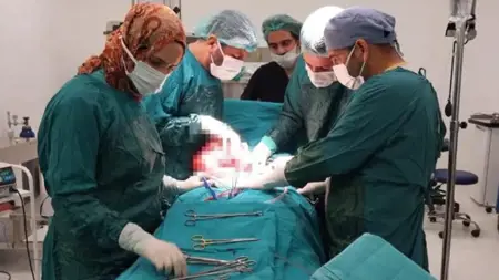 إزالة كتلة بحجم 35 سنتيمترًا من بطن امرأة في ديار بكر إزالة كتلة بحجم 35 سنتيمترًا من بطن امرأة في ديار بكر