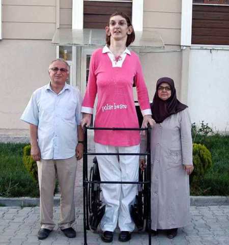 أطول امرأة في العالم ...من هي؟
