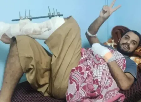 شاب فلسطيني في غزة يوجه نداءًا عاجلًا للمسؤولين.. "أنقذوني قبل بتر أطرافي"