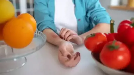 هل تعاني من حساسية أكثر من السابق؟.. طبيب تركي يوضح هل تعاني من حساسية أكثر من السابق؟.. طبيب تركي يوضح