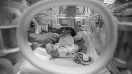 موت الرضع حديثي الولادة في مستشفى الشفاء المحاصر بسبب نقص الأكسجين والحليب
