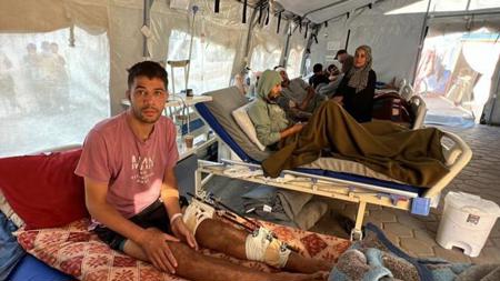ما هي أكثر الإصابات التي يصاب بها الفلسطينيين بسبب الحرب في غزة؟