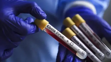 منظمة الصحة العالمية تعلن نهاية تفشي الإيبولا في أوغندا