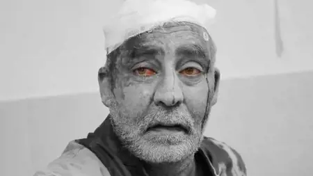 الجيش الإسرائيلي يستهدف مستشفى الشفاء حيث يتواجد آلاف الجرحى والنازحين الجيش الإسرائيلي يستهدف مستشفى الشفاء حيث يتواجد آلاف الجرحى والنازحين