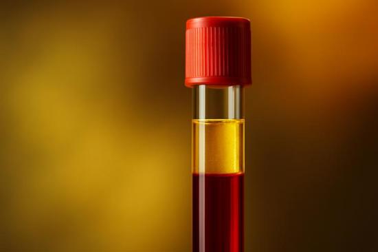 "الدم الذهبي".. أندر فصيلة دم في العالم وأمل العلماء في إنتاجه مخبريًا