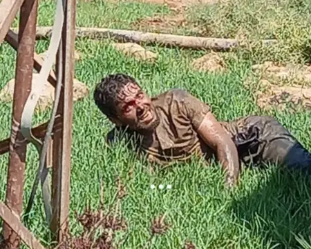 هرب مواطن سوري مصاب بداء الكلب من الحجر في شانلي أورفا هرب مواطن سوري مصاب بداء الكلب من الحجر في شانلي أورفا