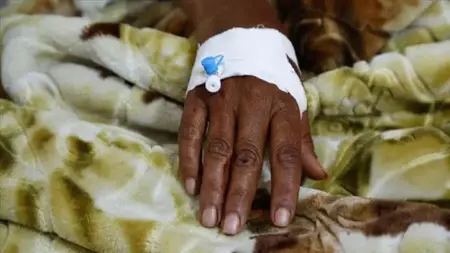 أكثر من 200 ألف شخص في السودان مهدَّدون بالكوليرا والحصبة ونقص الغذاء