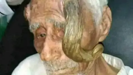 بعد بتر قرنيه بثلاثة أيام.. الموت يغيب المعمر اليمني "ذي القرنين"  بعد بتر قرنيه بثلاثة أيام.. الموت يغيب المعمر اليمني "ذي القرنين"