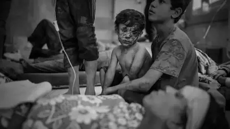 منظمة الصحة العالمية تعلن مصرع 10 أطفال في غزة بسبب الجوع منظمة الصحة العالمية تعلن مصرع 10 أطفال في غزة بسبب الجوع