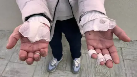 الكلاب الضالة تهاجم المارة في إسطنبول الكلاب الضالة تهاجم المارة في إسطنبول