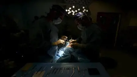 إزالة دودة حية بطول 8 سم من دماغ امرأة في أستراليا إزالة دودة حية بطول 8 سم من دماغ امرأة في أستراليا