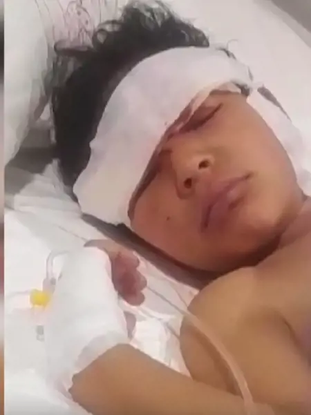 كلب ضال ينهش وجه طفل في أنقرة كلب ضال ينهش وجه طفل في أنقرة